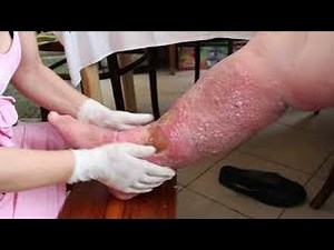 Documentaire 2016 L’obésité Causes Et Conséquences HD n