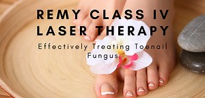 Laser for Toenail Fungus | Podiatrist, Foot Doctor Hallandale Beach, FL 33009