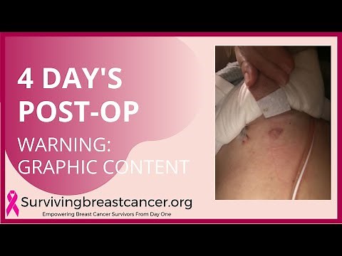 Post Lumpectomy Bra and Drains