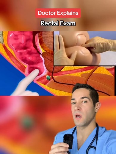 You might need to know this one day #rectalexam #medical #prostateexam #health
