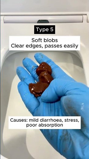 7 Types of Poo