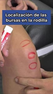 ¿Sabes cuántas bursas tiene la rodilla?樂 Te mostramos su localización e importancia clínica aquí  #rodilla #bursas #repaso #fisioterapia #fisio #fisiolover #fisioterapeuta #fisioterapiaenmovimiento #ortopedia | Fisioterapia en Movimiento | Facebook