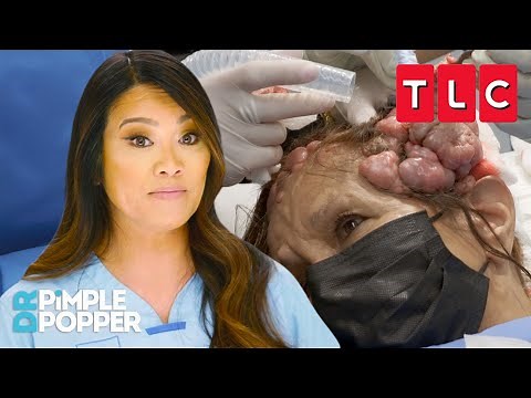 All the Pops from Season 8 | Dr. Pimple Popper | TLC