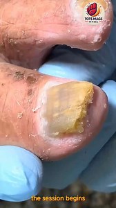 11K views · 93 reactions | Trusted senior nail routines that support clear, tidy everyday hygiene ️殺 #SoftCareRoutine #HomeCareIdeas #SteadyWellness | Tots Mags Wheel | Facebook