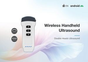 [Hot Item] Color Ultrasound Scanner Portable Machine for Patient