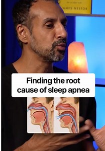 “I reversed my own sleep apnea by fixing the root cause instead of masking symptoms with a CPAP.” This is what can happen when you expand your airway. Book your evaluation at airwayhealth.com #airwayhealth #sleepapnea #rootcause #breathing #healthhacks
