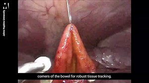 Robot performs keyhole surgery on pig without human help for first time