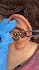 77K views · 103 reactions | Gold chain removed from ear | Big-Time Amusement | Facebook