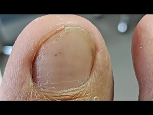 Pedicure From Japan😍#satisfying