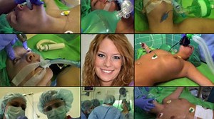 Britney Rib Surgery Procedure, 02, BP, Ambu, Intubation (in HD 1920X1080) | Clips4sale