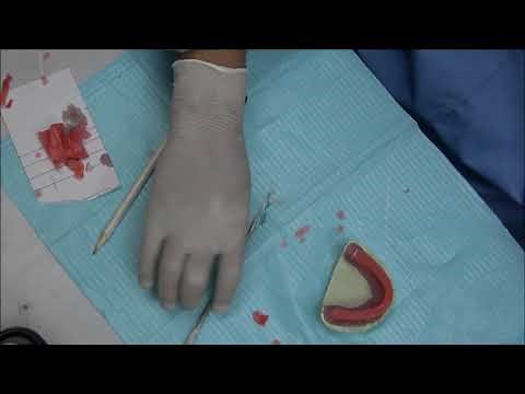 COMPLETE DENTURE: 5. Construction of Record Block - The Occlusal Rim