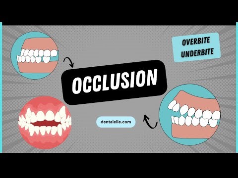 Explaining Dental Occlusion Types, Issues, and Treatments
