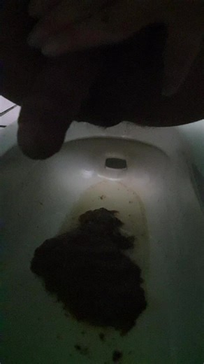 taiwan boy squat poop diarrhea 22