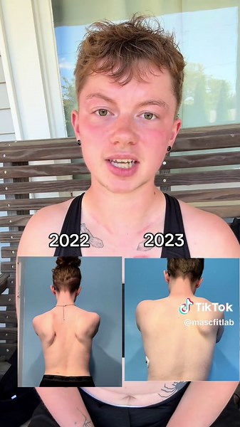 Understanding Paget-Schroetter Syndrome and Pain Management