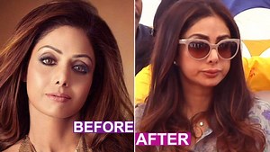 Sridevi’s Plastic Surgery Goes WRONG? Viral Video Claims Bollywood Actress' Botched-up Lip Augmentation | 🎥 LatestLY