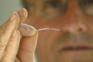 Implants contraceptifs Essure : plusieurs femmes ont décidé d'agir contre l'État