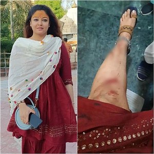 Tanushree Dutta escapes road accident 'with a few stitches' after brake failure; jokes about bruised leg