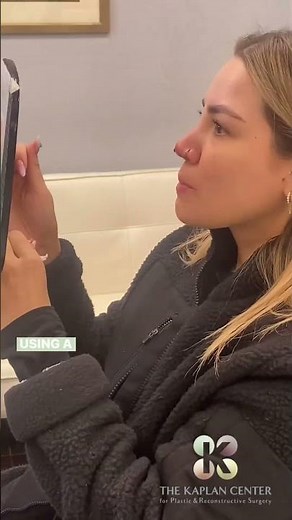 #Non-Surgical #Nose Job using PDO #Threads