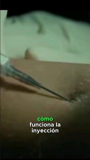 Cómo funciona la inyección LETAL?