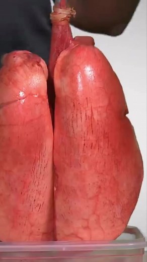 2.2K views | Have you seen a real lung of smoker ? Prepare to be shocked! #smoker #lungcancer #pulmonologist | Dr. Aslam Pulmonologist | Facebook