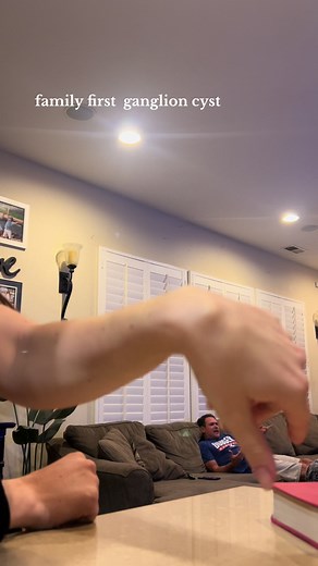 how to pop a ganglion cyst safely