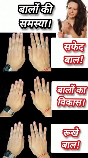 Hair problem 💥 #vikrantranayoga #yogalifestyle #handexercises #hairproblems #instagram #viralreels | Vikrant Rana