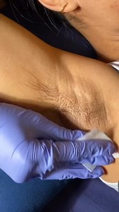 253 reactions · 7 comments | A Cera Aromen acalma a pele ela é mais fina e elástica sendo assim rende muito mais, é indicada para todas as partes do corpo, ela dilata os poros e facilita a remoção dos pelos, até mesmo das regiões de difícil acesso. Esta cera pode ser aquecida em banho-maria ou aquecedores elétricos termoceras. Www.mercadobigwer.com.br #depila #depi #Depilação | Aromen Cera Anestésica | Facebook