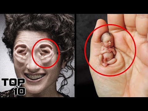 Top 10 Unusual People That Are One In A Million | Marathon