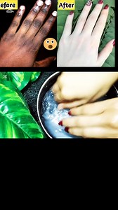 Hand Foot Whitening Tips For Winter #handwhitening#footcare#dryhandsolution | Simple Beauty Tips