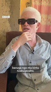 ‘Ntimukatugirire impuhwe’ – Inkuru y’umuhanzi Patrick Mazimpaka uzwi nka 'Karabo Kimana' ufite ubumuga bw’uruhu | BBC News Gahuza