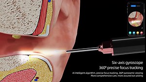 Ear Cleaner with Camera, GOOLSUN Ear Wax Removal, Upgraded 1296P Ear Camera Wax Removal, Earify Wireless Otoscope with 6 LED Lights, Ear Cleaning Kit for Adults and Kids, Black