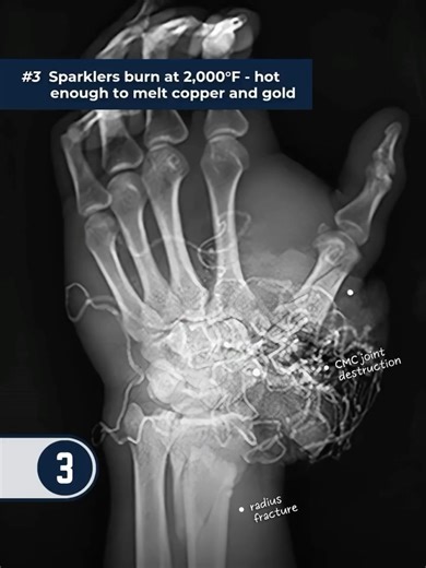 North American Rescue on Reels