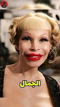 Celebrities before and after plastic surgery 😰😳 (Part 4)