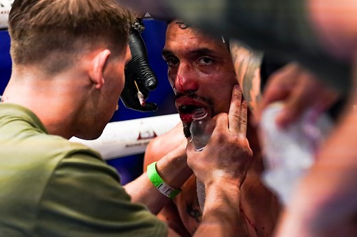 A champion’s voice when you need it most 🗣 #BKB39 #BKB #BareKnuckle | BKB Bare Knuckle Boxing