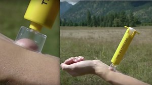 You Buying This Backcountry Snake Bite Vacuum Pump Venom Extractor?