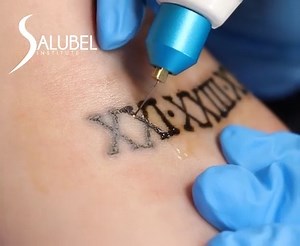 ¡Elige Plasma Pen como método de remoción de tatuajes!⚡ Es una técnica ✅Segura y ✅Eficaz, que además también nos permite remover trabajos de micropigmentación, de forma que podamos corregir el diseño sin dañar la piel殺 ¿Ya conoces esta técnica?✨ Envíanos mensaje y capacítate con nosotros. #plasmapen #tatuajes #remocióndetatuajes #tattoo #fibroblast #beautymonster #maglev #microblading #micropigmentación | Salubel | Facebook
