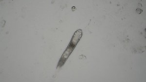 Demodex Facial Mites Under Microscope 库存影片视频（100% 免版税）1094479465 | Shutterstock