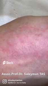 Would you like to learn Nanofat injection techniques?