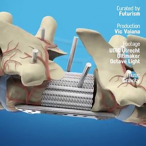 412K views · 3.3K reactions | The future of medicine is in 3D printing — like printing out literal organic tissue | Futurism | Facebook