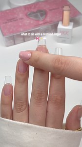 crooked finger? ✨ | Nailz katkat