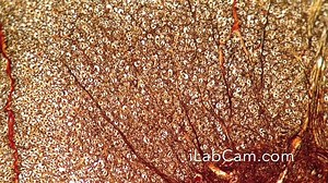 With LabCam, you can capture exatly what you see in the microscope simply by inserting LabCam into the eyepiece slot. www.ilabcam.com | LabCam