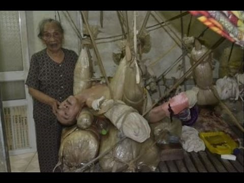 【閲覧注意】虐待？47年間ロープに吊るされた男とは（難病指定）