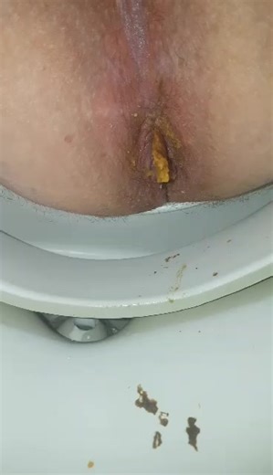 Second hangover shit of the day, in bowl view