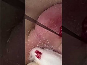 Satisfying Bloody Mass Extraction: Watch It Pop!