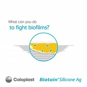 Biofilms in wounds can be difficult to treat and may delay healing if they persist. So, what can you do to manage infected wounds? Here are a few things to keep in mind: 1. Look out for exudate pooling, slough, and non-viable tissue, as this may lead to increased bacterial load that can delay healing. 2. Excess exudate increases the risk of maceration, and thereby infection in the wound edge and periwound skin. For optimal healing conditions in infected wounds, you need a dressing that addresses