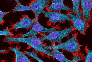 Deep learning to fight cancer: Fireside chat with Peter Norvig and Abu Qader