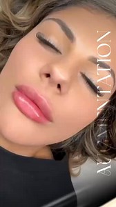 Beautiful 😻 Russian lips 👄 🤍doll lips 💋 -OPULENT BEAUTY CLINIC 💕 client B-Doll lips✨ $ RUSSIAN TECHNIQUE😘 to shape and lift the lips co 28beautiful #beauty #lips #antiaging #injections #cosmetic #skin #facial #wrinkles #lipaugmentation #face #fillers #antiwrinkle #lipfiller #onaesthetics #juicylips #definedjawline #contouredjawline #pdocogsthreads #semipermanent #fyp #typ#aestheticsessex #aestheticsclinicessex #viral | Opulent beauty clinic. Lip fillers