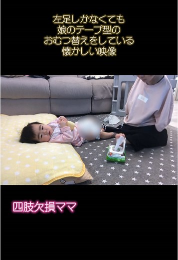 四肢欠損ママの育児体験