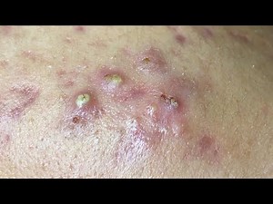 Satisfying and Relaxation with SURI NGUYEN Beauty Spa Video #419