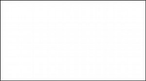 MPNs or myeloproliferative neoplasms is a group of chronic type of blood cancers that may be progressive in certain states. In this segment, top MPN specialist, Dr. John Mascarenhas of Mt. Sinai in New York City, describes the different types of MPNs (including categories of Ph positive and Ph negative), first signs of MPNs, and much more. Featuring: John Mascarenhas, Dir., Adult Leukemia Program, Tisch Cancer Institute, Mt. Sinai & Professor, Icahn School of Medicine . . . #ThePatientStory #mye